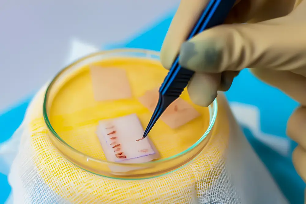 Haartransplantation Schulungsprogramme 1 5e394dc1b8d72 Haartransplantation Schulungsprogramme